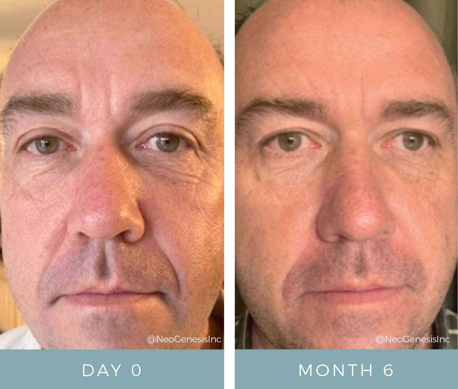 Before + After - Mature + Aging Skin - Skincare Products for Men