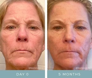 Before + After - Aging Skin