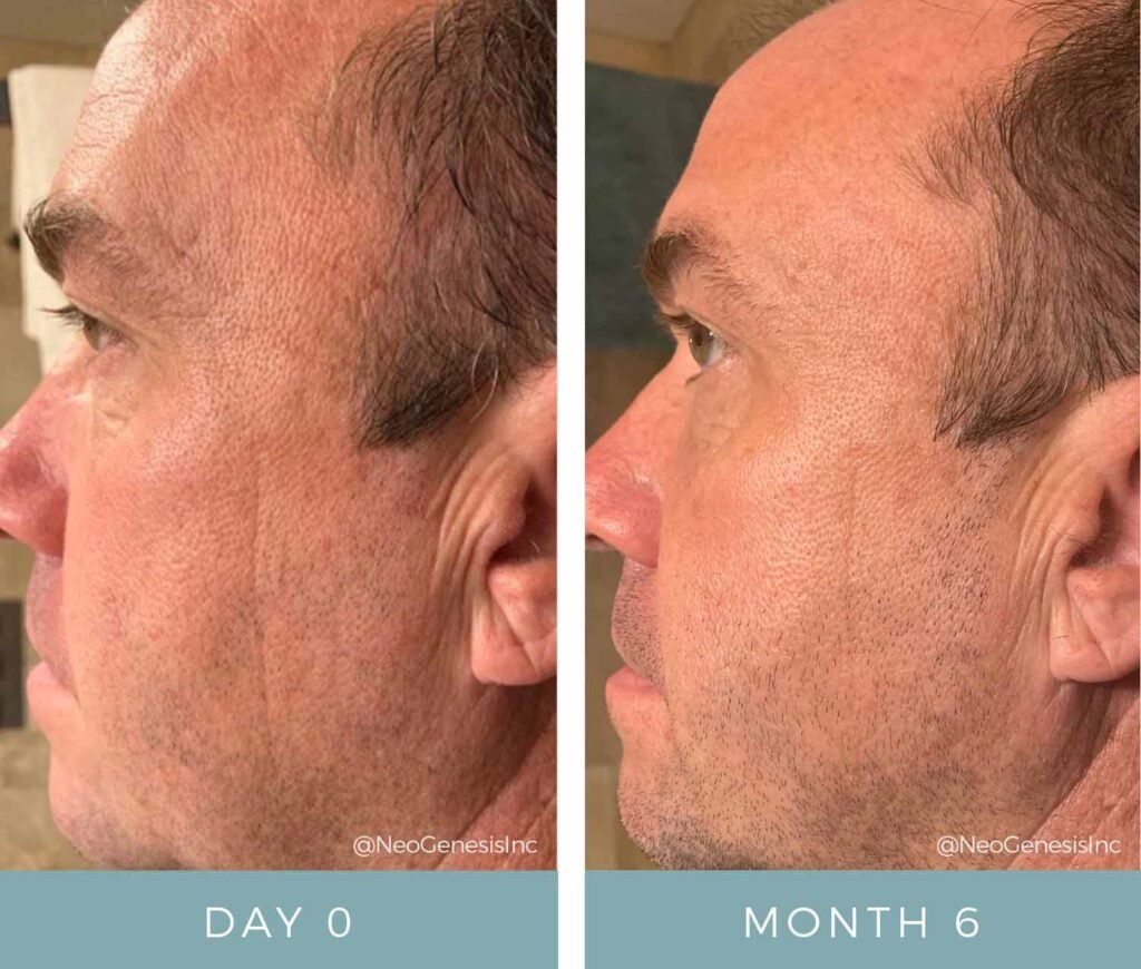 Before + After - Aging Face - Male