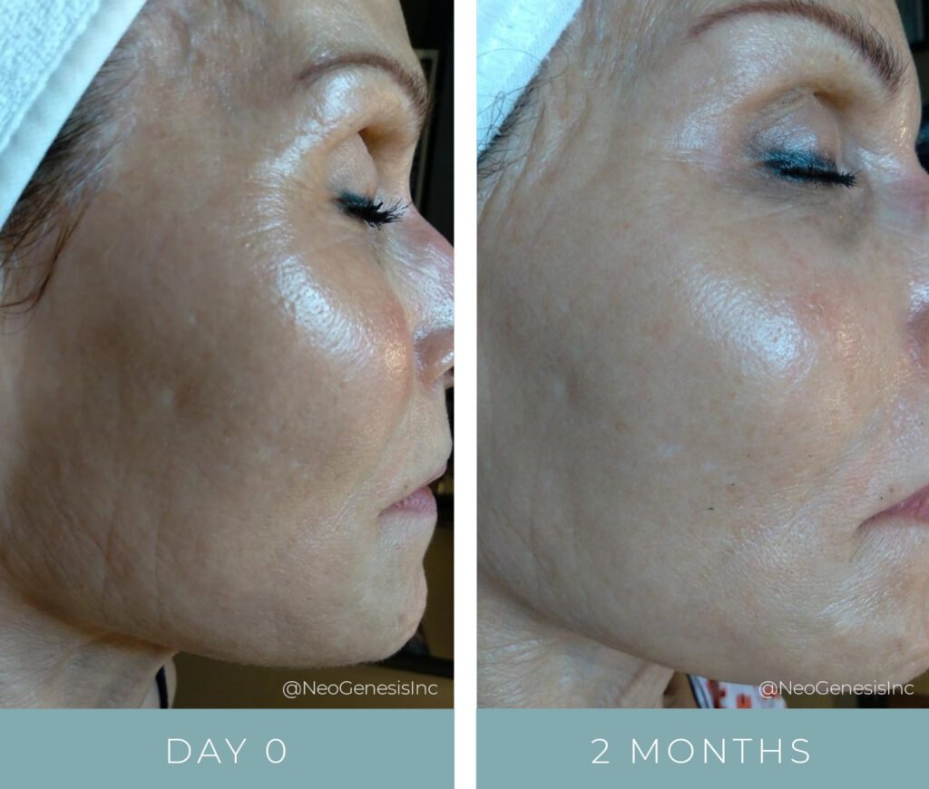 Before + After - Aging Skin