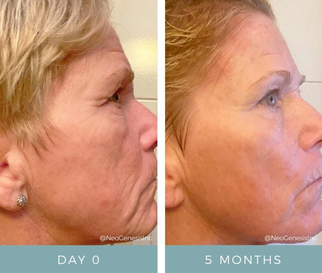 Before + After - Aging Skin