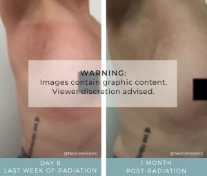 Before + After - Radiation Skincare