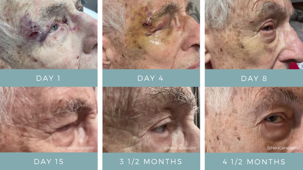 Before + After - Wound Care