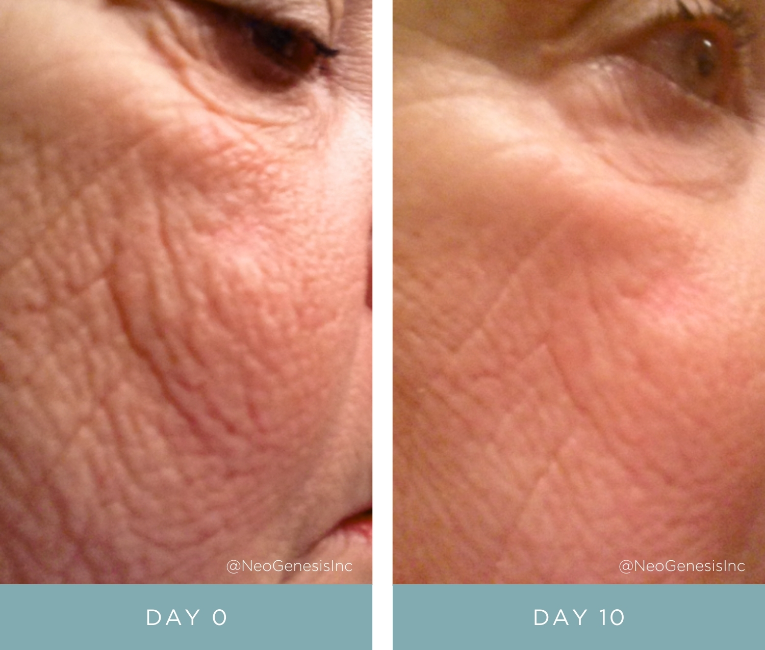 Before + After - Aging, Dry Skin