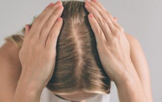 7 Tips for Managing Hair Loss