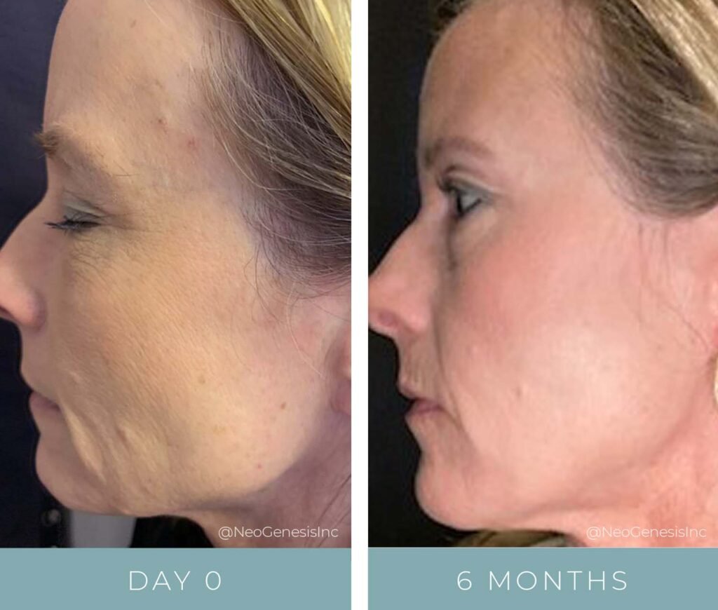 Before + After - Aging Skin