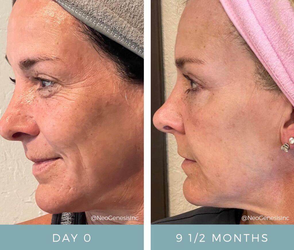 Before + After - Aging Skin