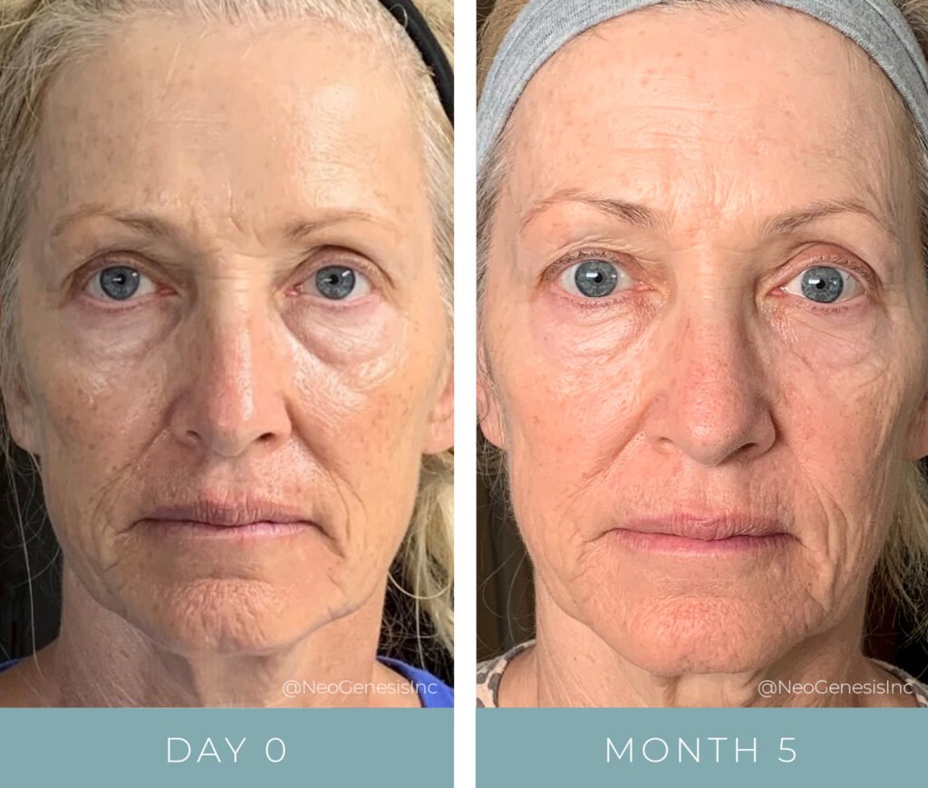 Before + After - Aging Skin