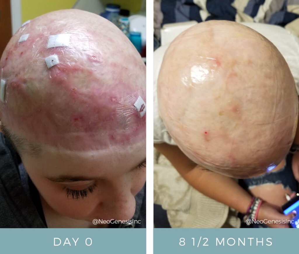 Before + After - Wound Care for Scalp Injury