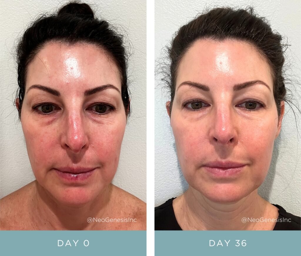 Before + After - NeoGenesis Vibrant C Serum for Mature + Aging Skin